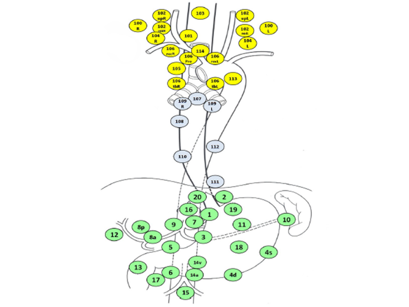 Esophageal Cancer