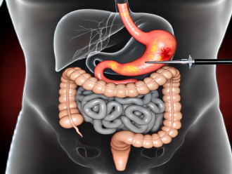 Esophagogastroduodenoscopy