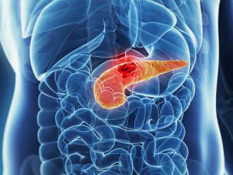 Pancreatic Diseases