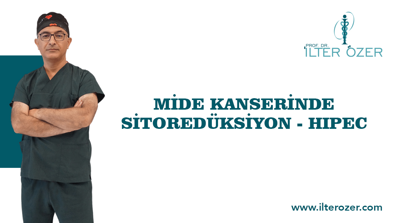 Mide Kanserinde Sitoredüksiyon - HIPEC